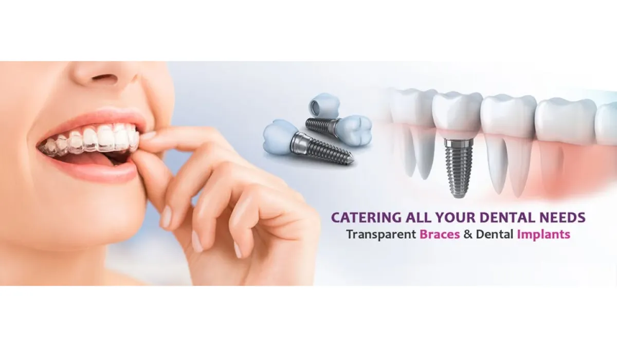 Galaxy Dental Care | Best Dental Clinic In Kukatpally 2